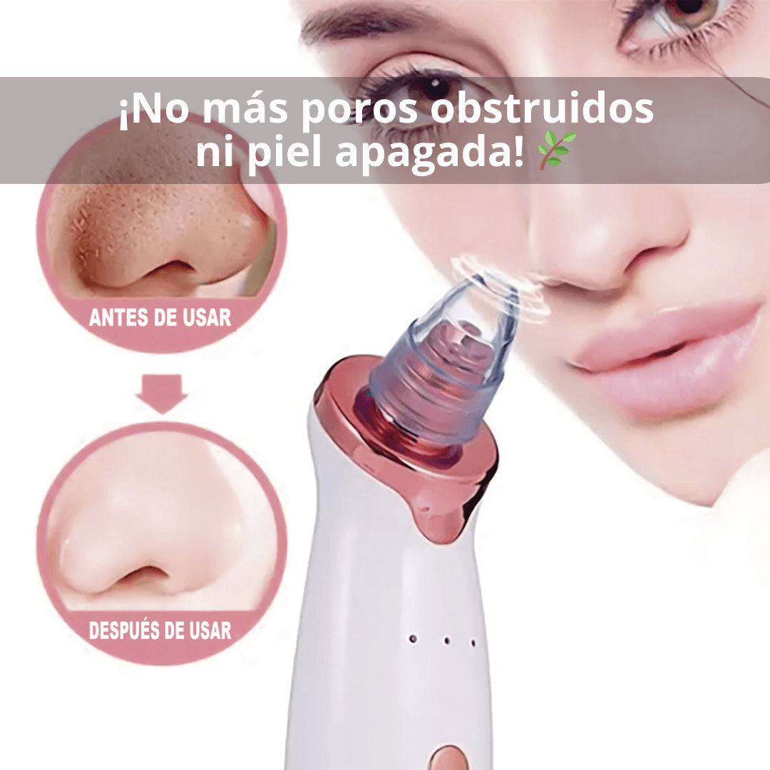 Extractor De Puntos Negros Bella Cleaner F3