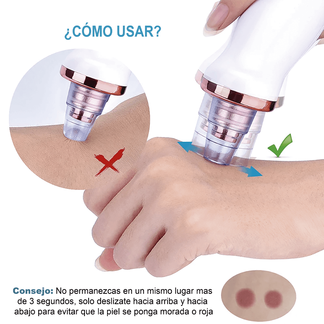 Extractor De Puntos Negros Bella Cleaner F3